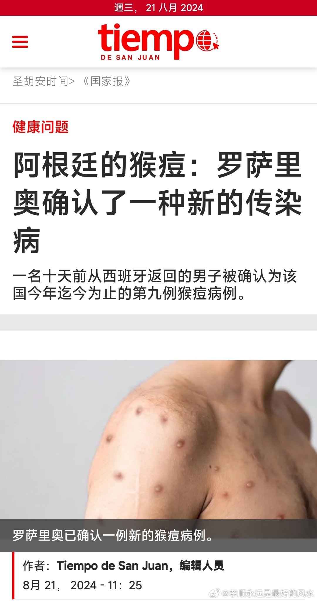 阿根廷猴痘疫情分析，78例确诊与防控科普探讨