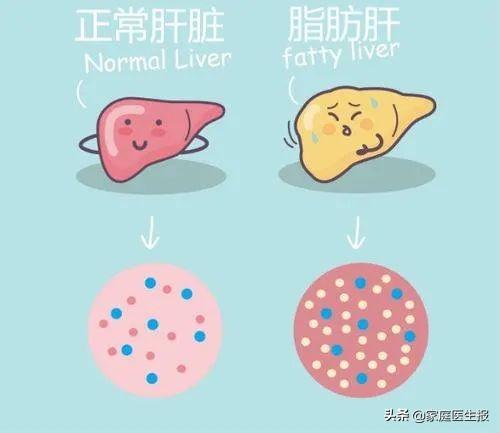 间质性肺病最新特效药研究及其论述